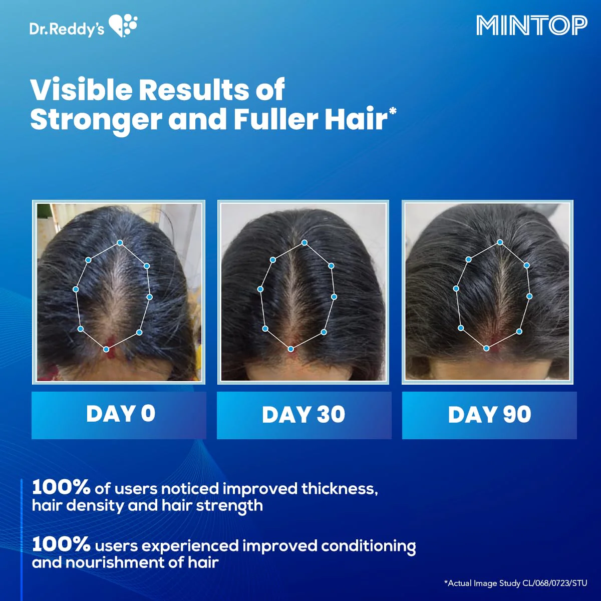 Mintop Pro Plus| Hair Regrowth Serum by Dr Reddys|Fortified with Redensyl Procapil Biotin and Copexil| Proven Hair Fall Control| Scalp Nutrition| 50 Ml - Image 7